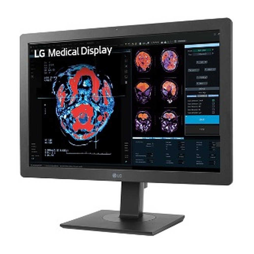MONITOR LGX 24INCH 2MP IPS DIAGNOSTIC